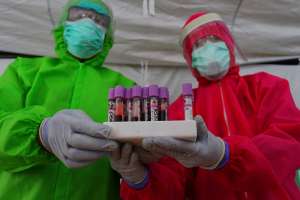Mutasi Virus Corona D614G ada di DIY, Ini Kata Sultan